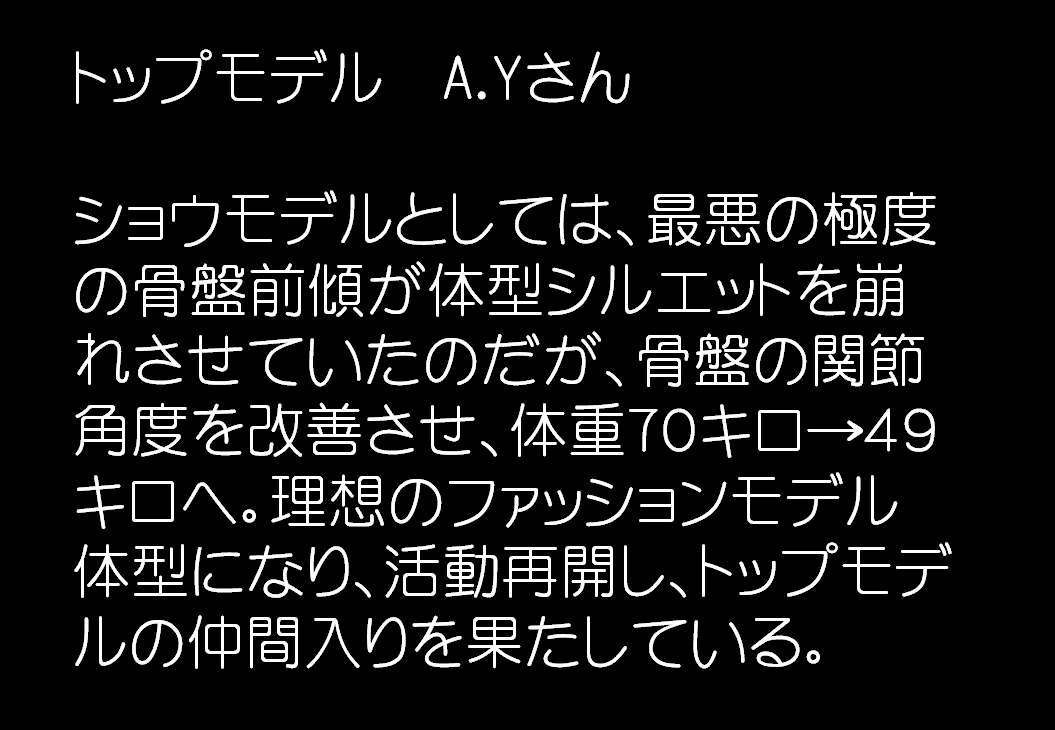 トップモデル　A.Yさん、ショウモデルとしては、最悪の極度の骨盤前傾が体型シルエットを崩れさせていたのだが、骨盤の関節角度を改善させ、体重７０キロ→４９キロへ。理想のファッションモデル体型になり、活動再開し、トップモデルの仲間入りを果たしている。