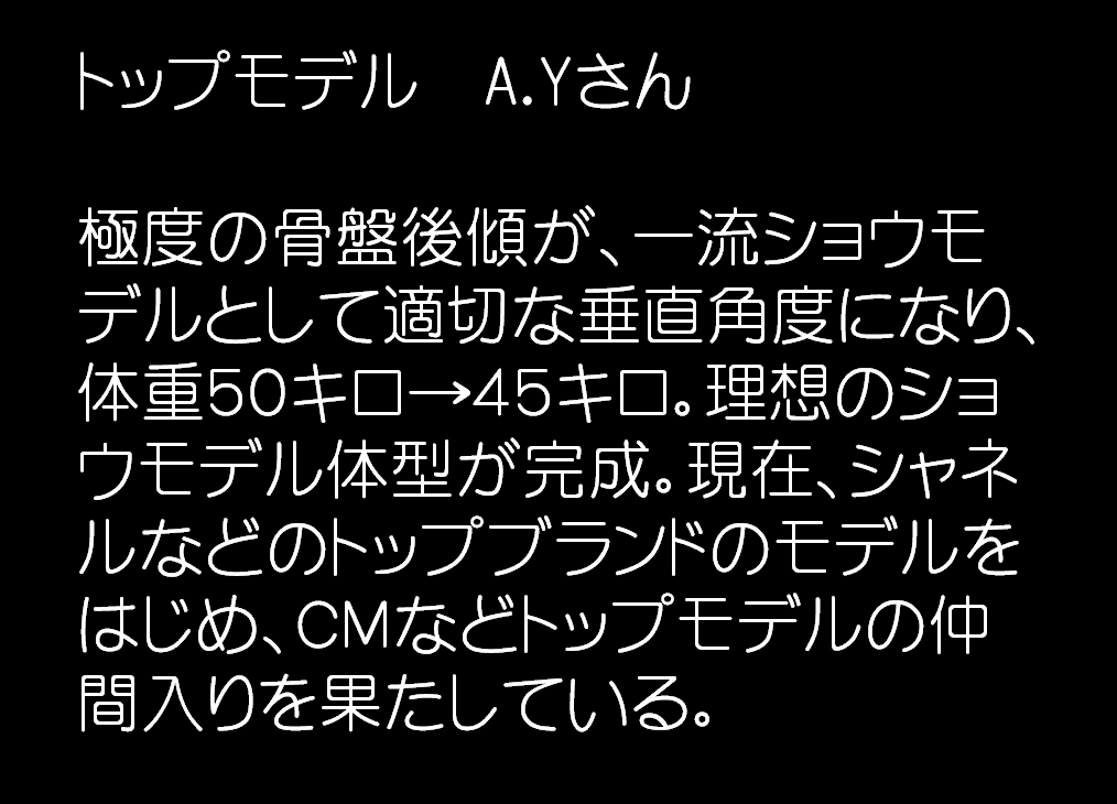 トップモデル　A.Yさん。極度の骨盤後傾が、一流ショウモデルとして適切な垂直角度になり、体重５０キロ→４５キロ。理想のショウモデル体型が完成。現在、シャネルなどのトップブランドのモデルをはじめ、ＣＭなどトップモデルの仲間入りを果たしている。