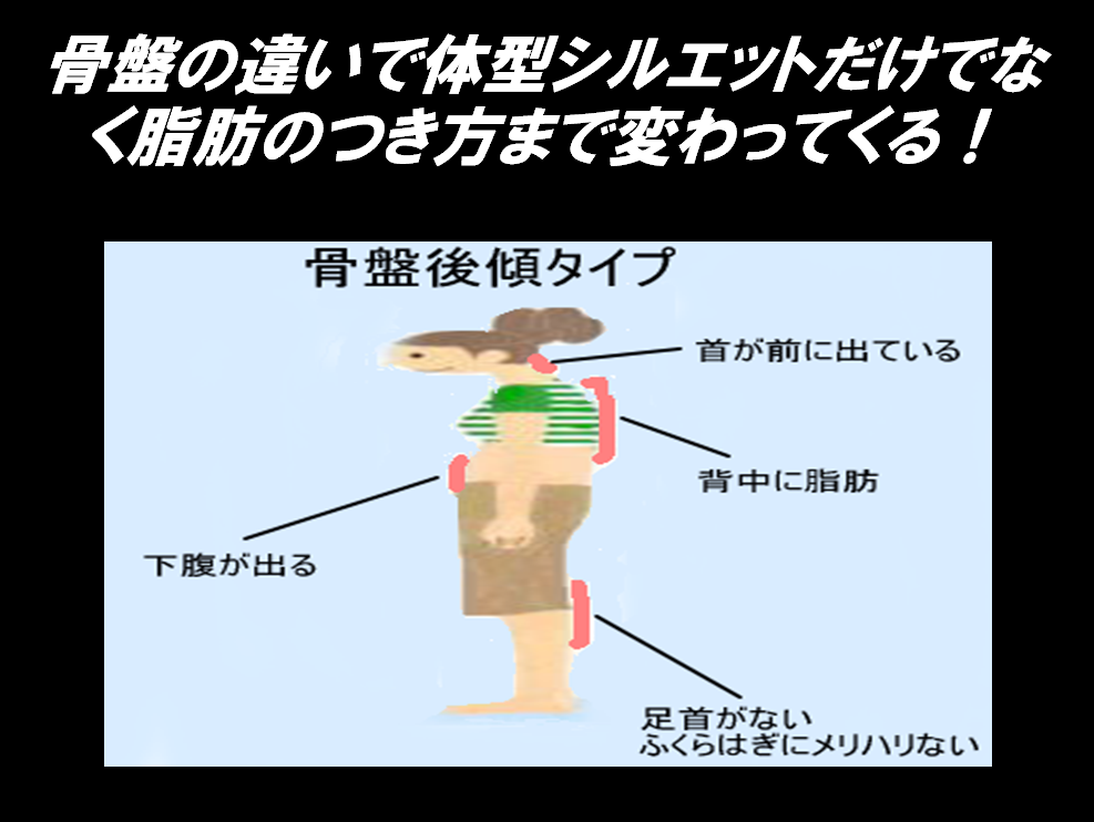 骨盤後傾｜シセトレ　姿勢トレ　ダイエット　シェイプスShapes